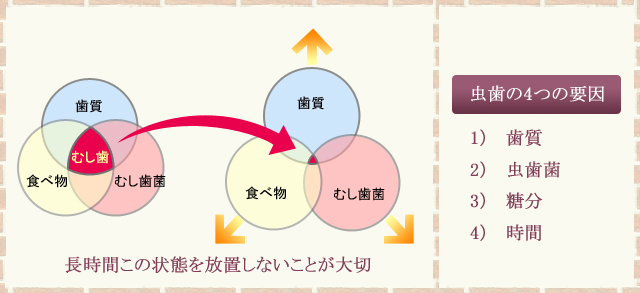 痛い 歯 食べ物 が 歯が痛い時の食べやすい食事・おススメ献立・調理のコツ｜ゴニョ研